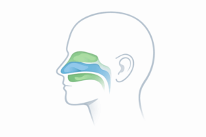 Chronic Nasal Congestion: Allergy, Infection, or Structural Issue?