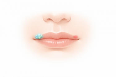 Cold Sores vs Other Lip Lesions: How Doctors Tell the Difference