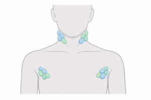 Swollen Lymph Nodes: Infection or Something More Serious?